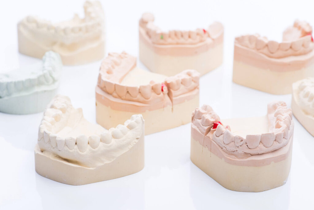 When to Use LSR vs. SSR in Silicone Injection Molding Projects